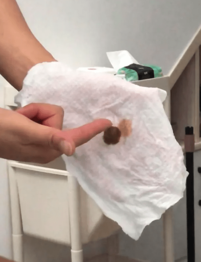 浙江多个小区自来水散发屎臭。
